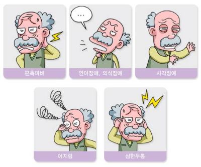 팔다리 힘 괜찮은데 설마 아니겠지…놓치기 쉬운 '가벼운 뇌졸중'